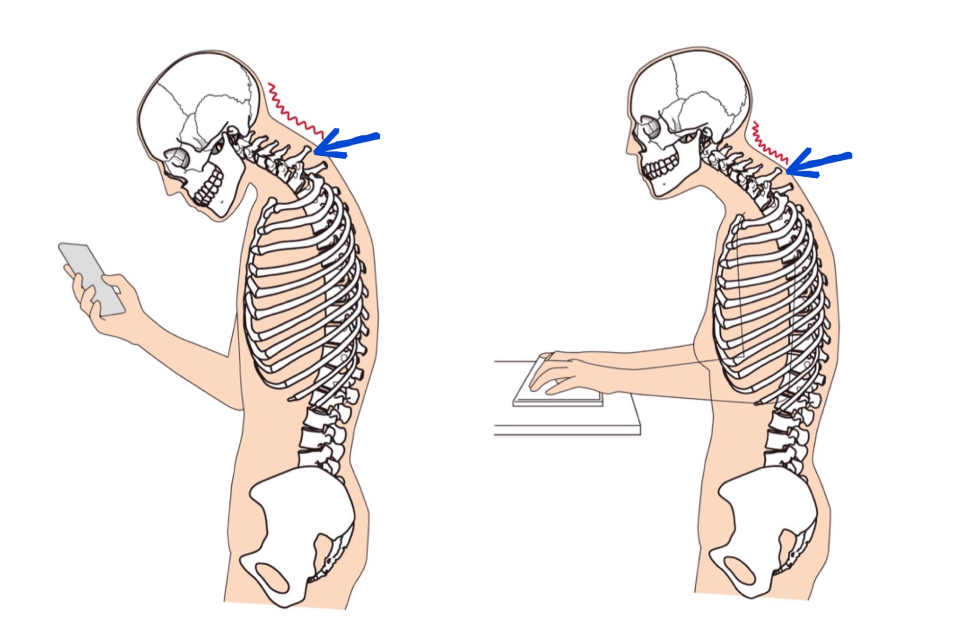 首の後ろボコッと骨が出っ張るのはなぜ？その原因と改善する体操3種 きれいな身体の作り方